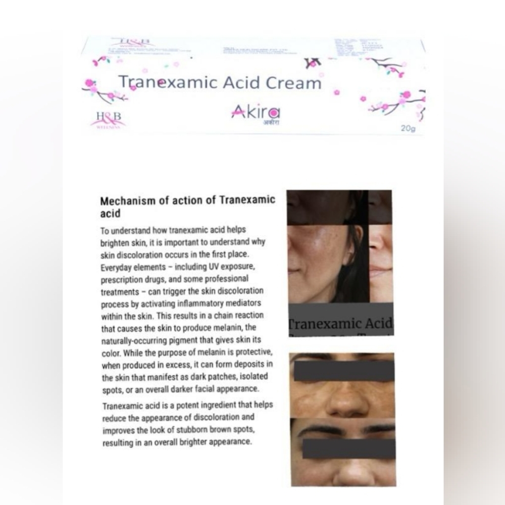 Tranexamic cream - Picture 2 of 2